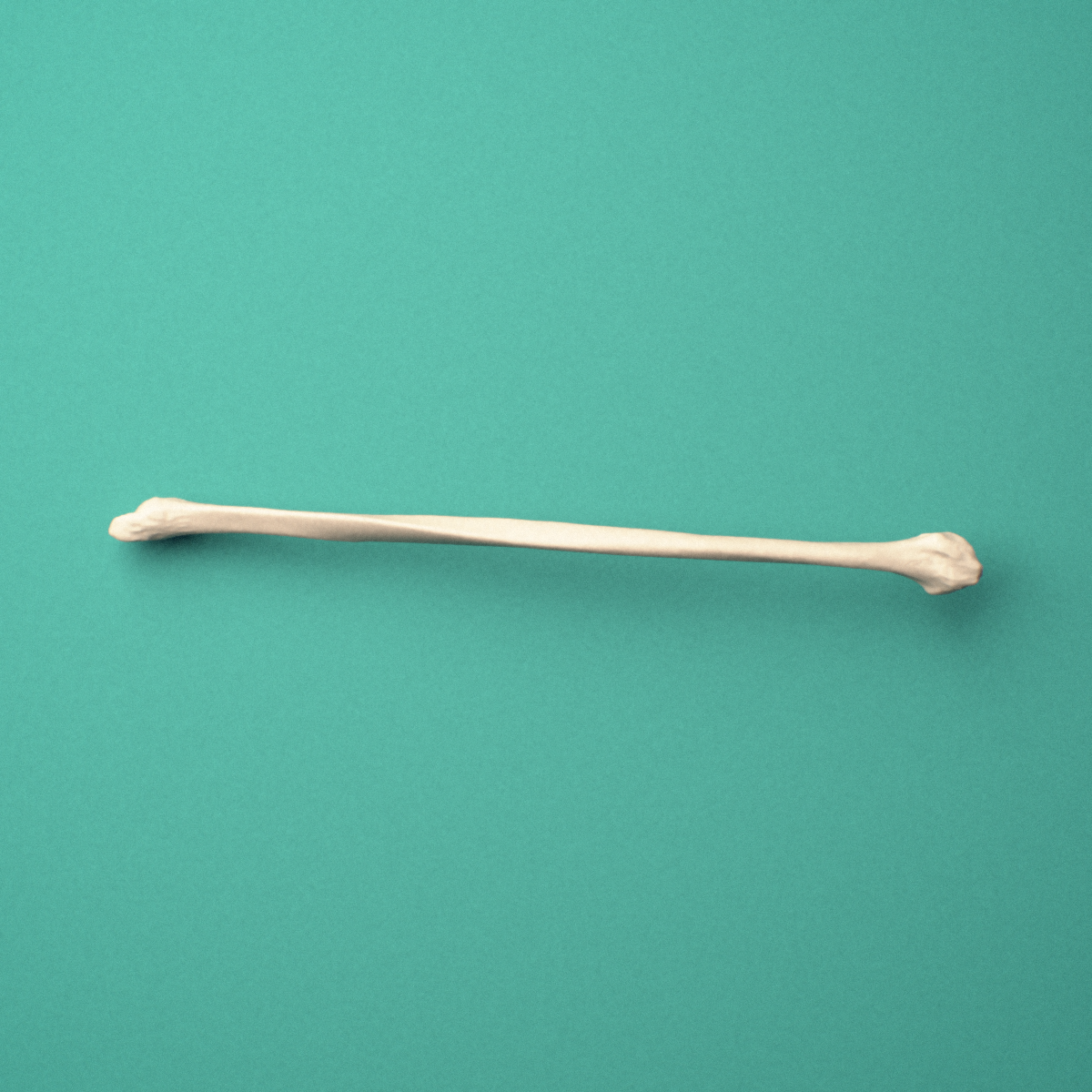 3D-printed Right fibula, oblique close-up view showing the fibular head.