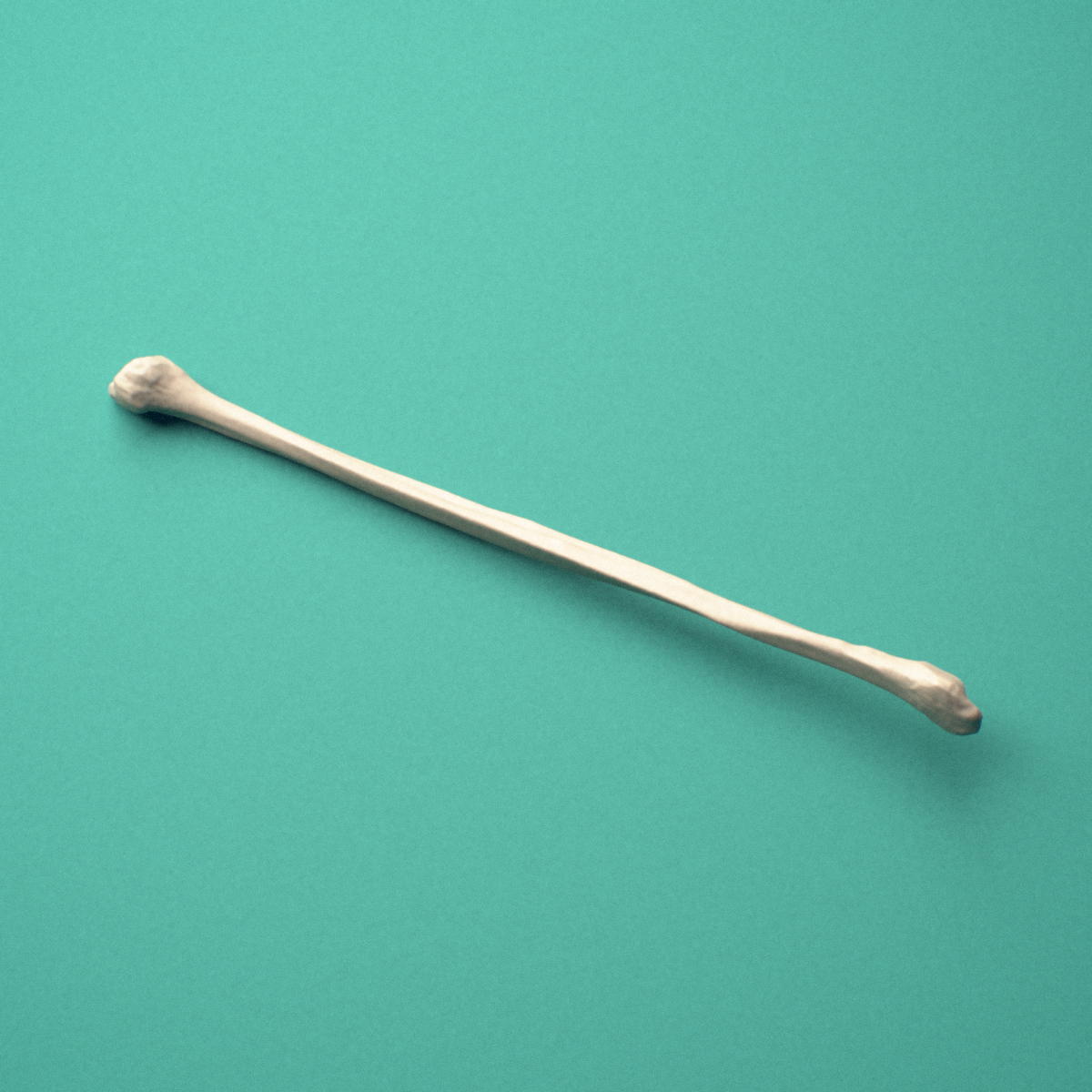 3D-printed Right fibula, oblique close-up view showing the lateral malleolus.