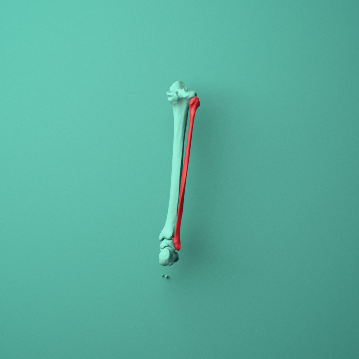 3D model of the Right fibula shown in position within a full knee and lower leg model, posterior view.