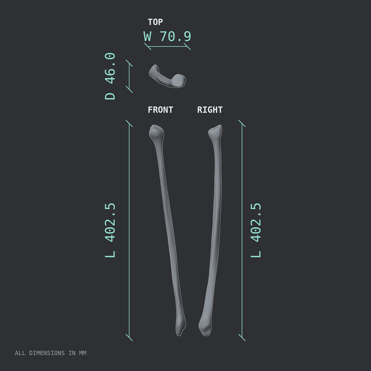 3D rendered dimensional drawing of the Right fibula, top, front, and side views.