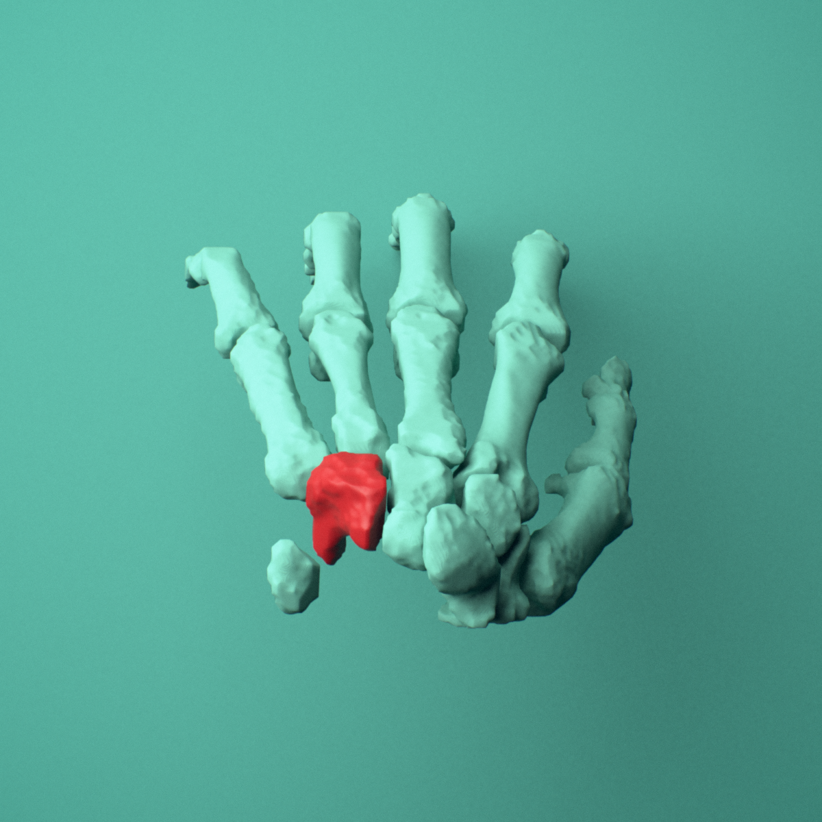 3D model of the Left hamate bone (wrist) shown in position within a full hand and wrist model, superior view.