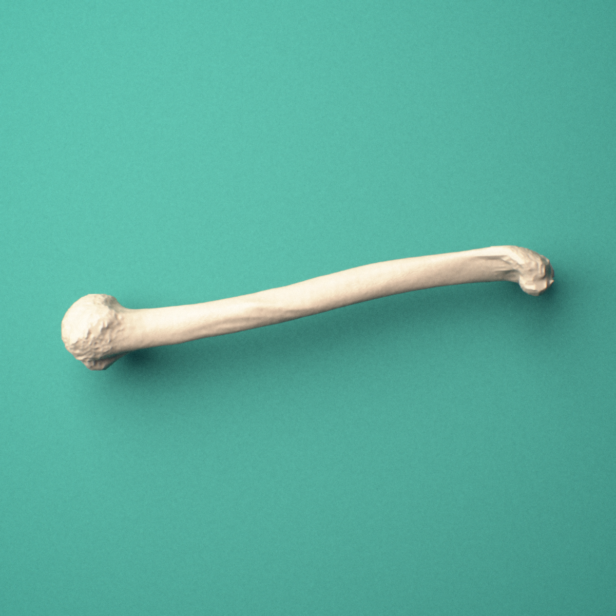 3D-printed Left humerus, oblique view showing the humeral head and greater tubercle and capitulum and trochlea.