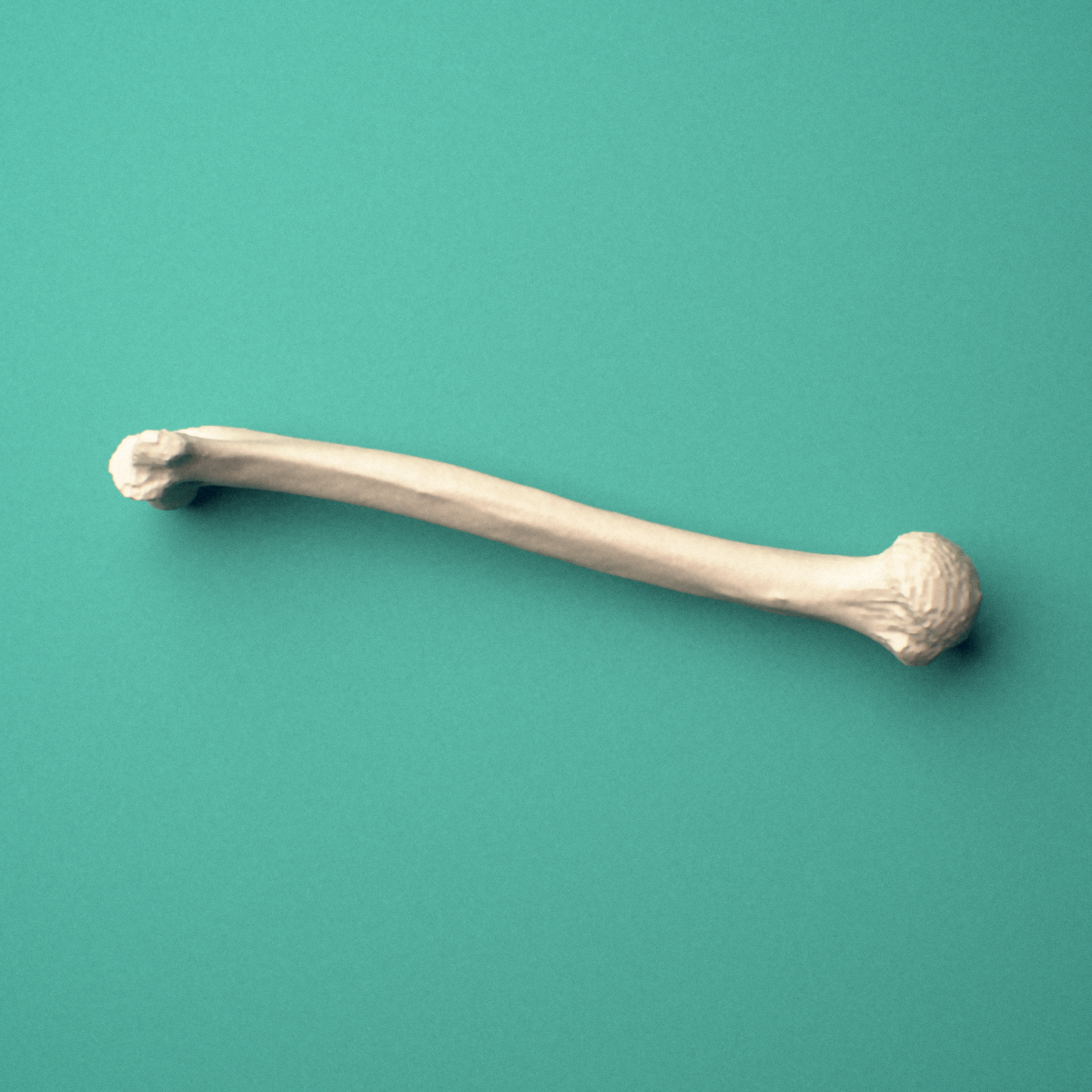 3D-printed Left humerus, oblique close-up view showing the humeral head and greater tubercle.