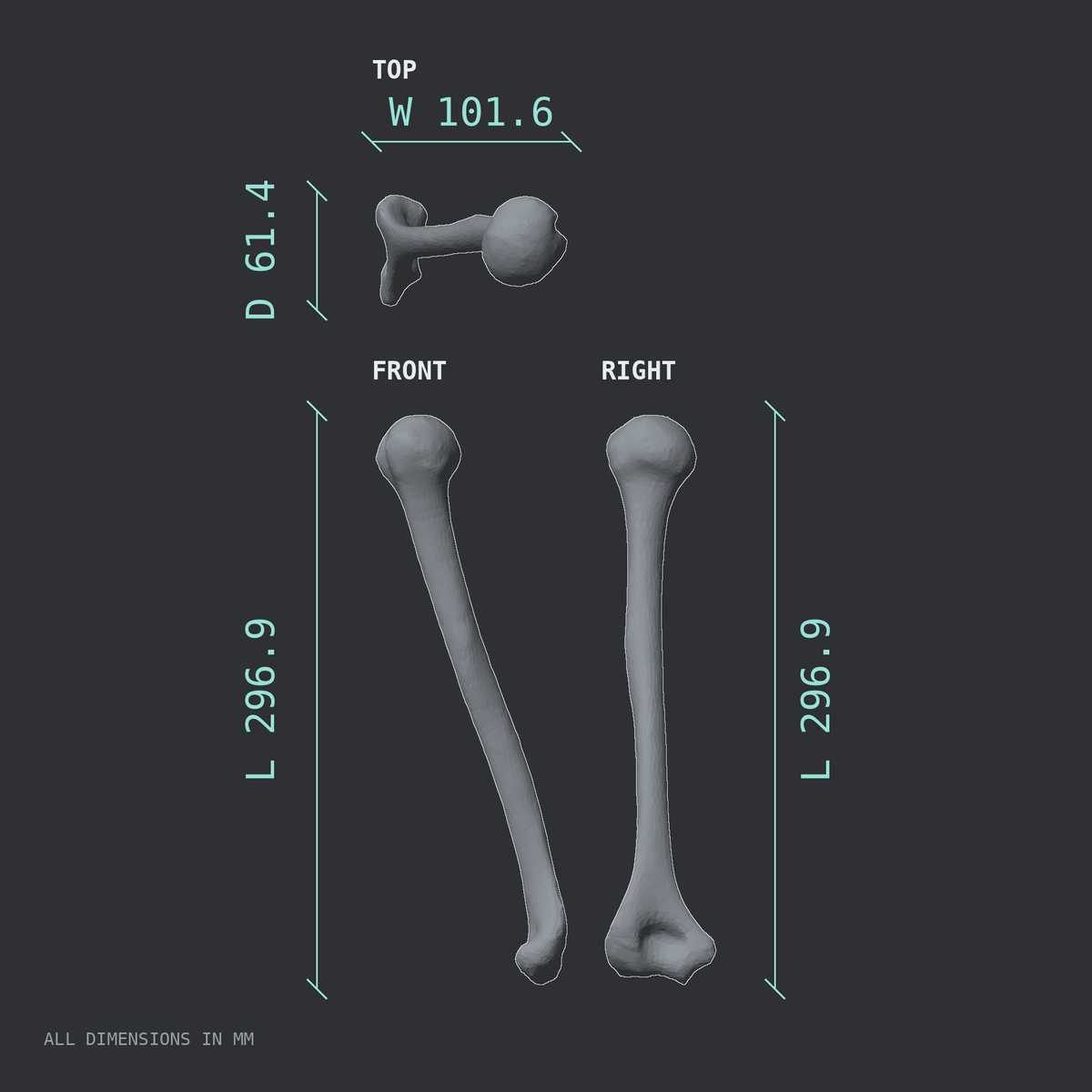 3D rendered dimensional drawing of the Left humerus, top, front, and side views.