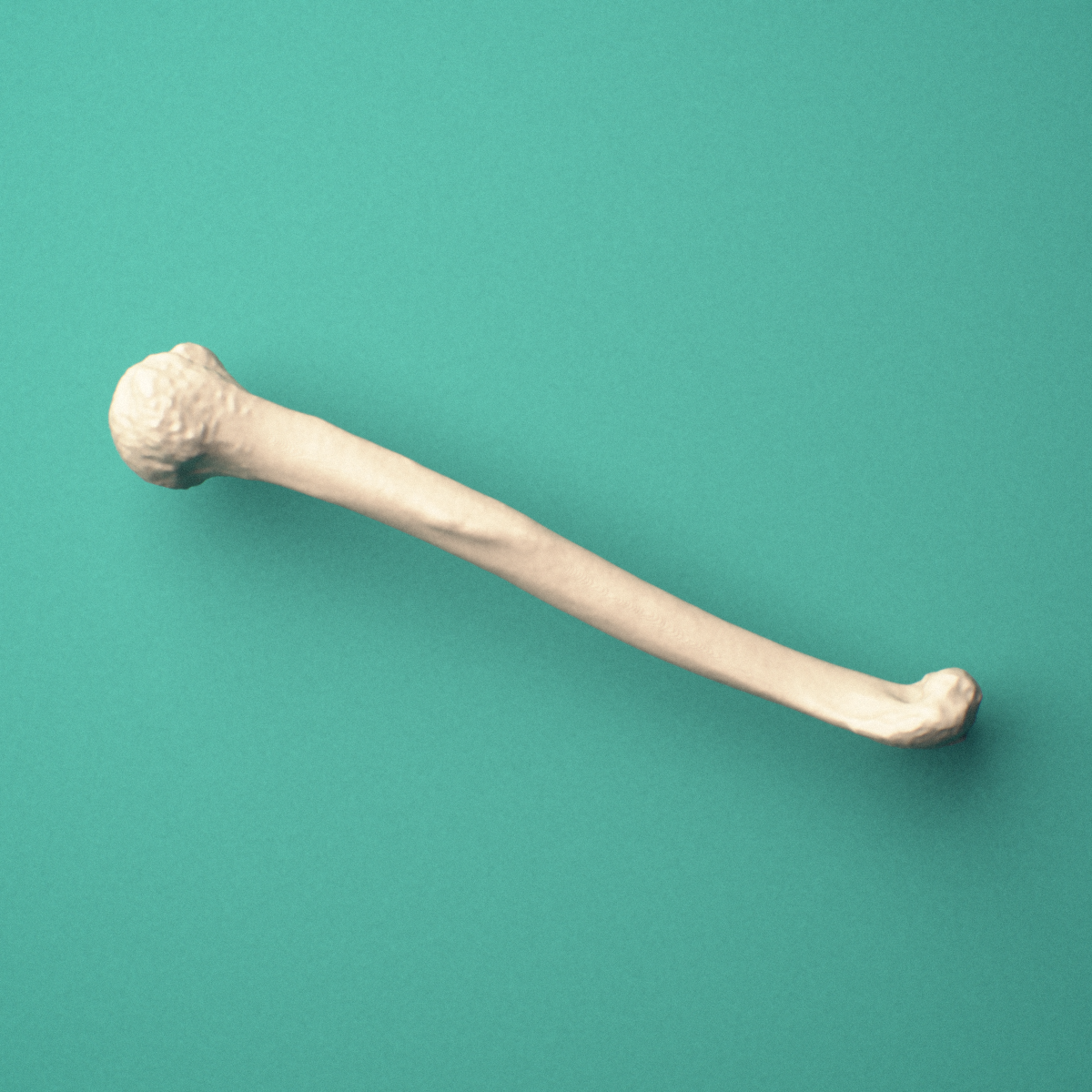 3D-printed Right humerus, oblique view showing the humeral head and greater tubercle and capitulum and trochlea.