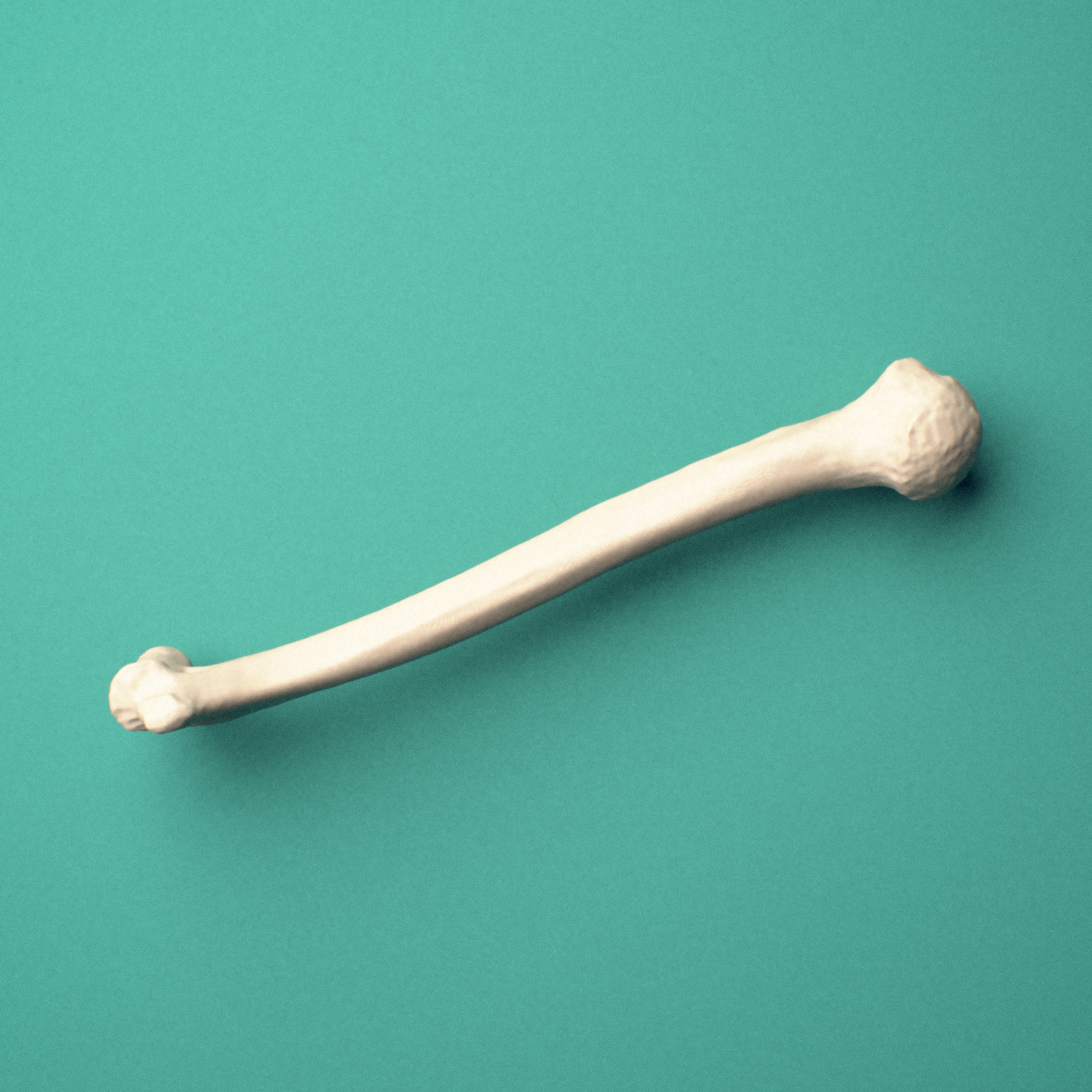 3D-printed Right humerus, oblique close-up view showing the humeral head and greater tubercle.