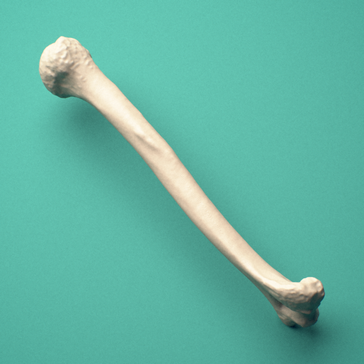 3D-printed Right humerus, oblique close-up view showing the capitulum and trochlea.