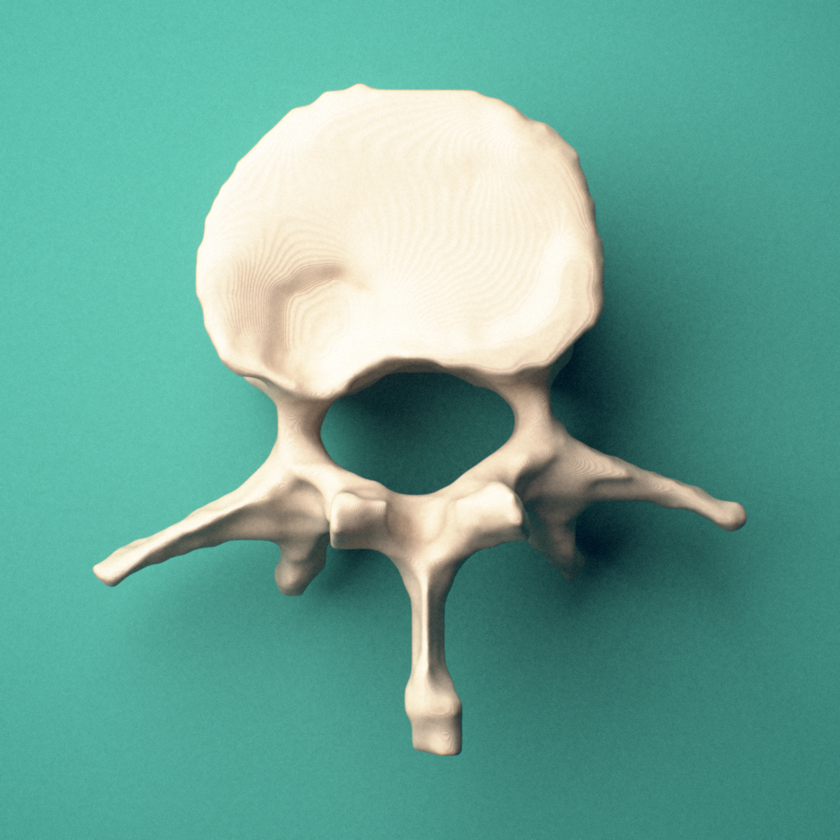 3D-printed L1 lumbar vertebra, superior oblique view showing the spinous process and superior articular processes.
