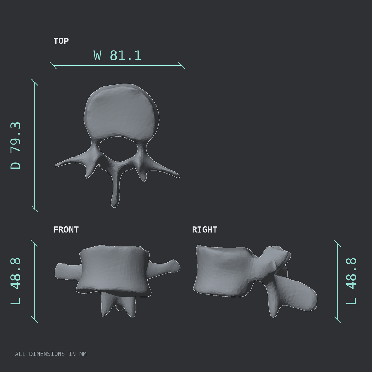3D rendered dimensional drawing of the L1 lumbar vertebra, top, front, and side views.