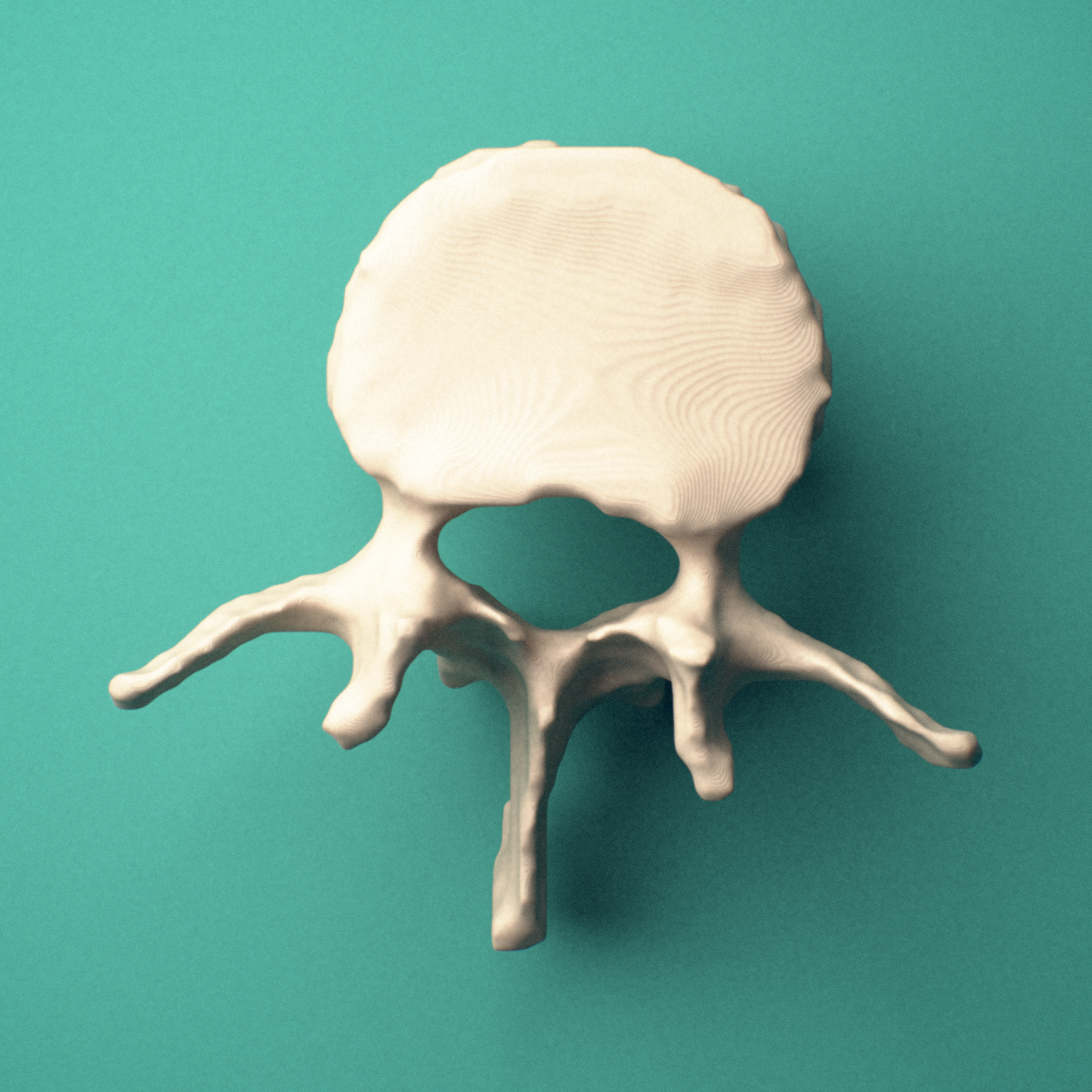 3D-printed L2 lumbar vertebra, superior view showing the vertebral body and vertebral foramen.