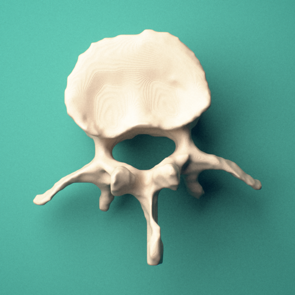 3D-printed L2 lumbar vertebra, superior oblique view showing the spinous process and superior articular processes.