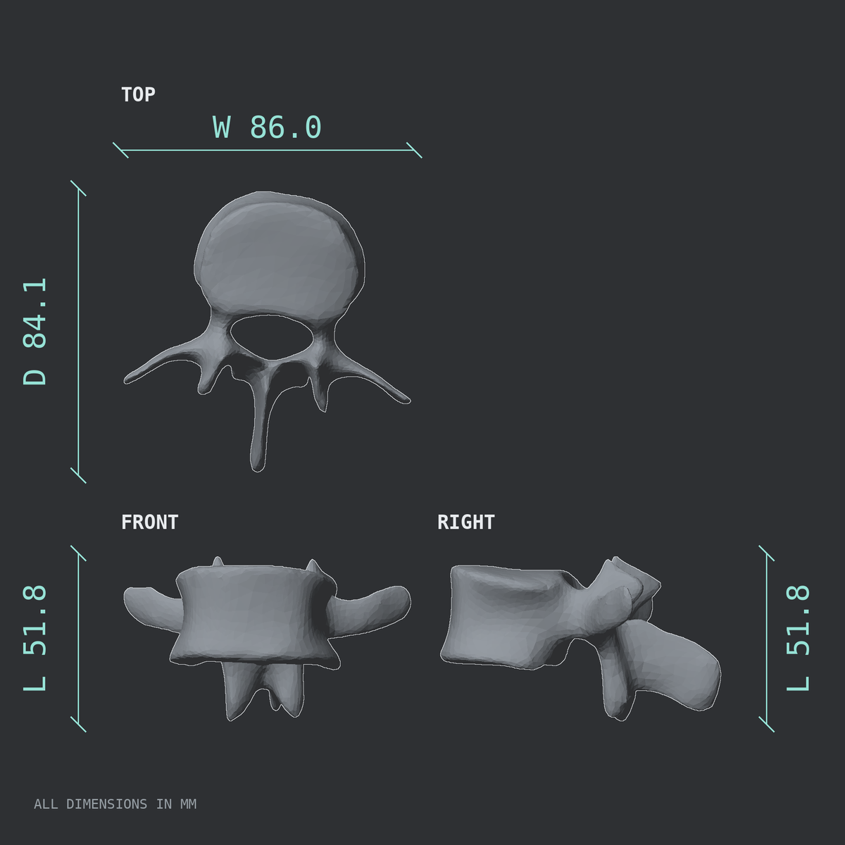 3D rendered dimensional drawing of the L2 lumbar vertebra, top, front, and side views.