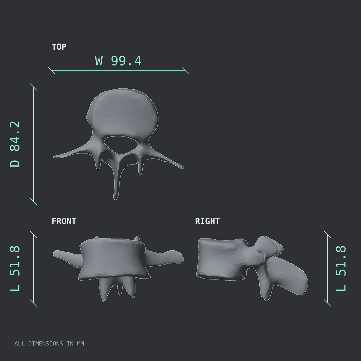 3D rendered dimensional drawing of the L3 lumbar vertebra, top, front, and side views.
