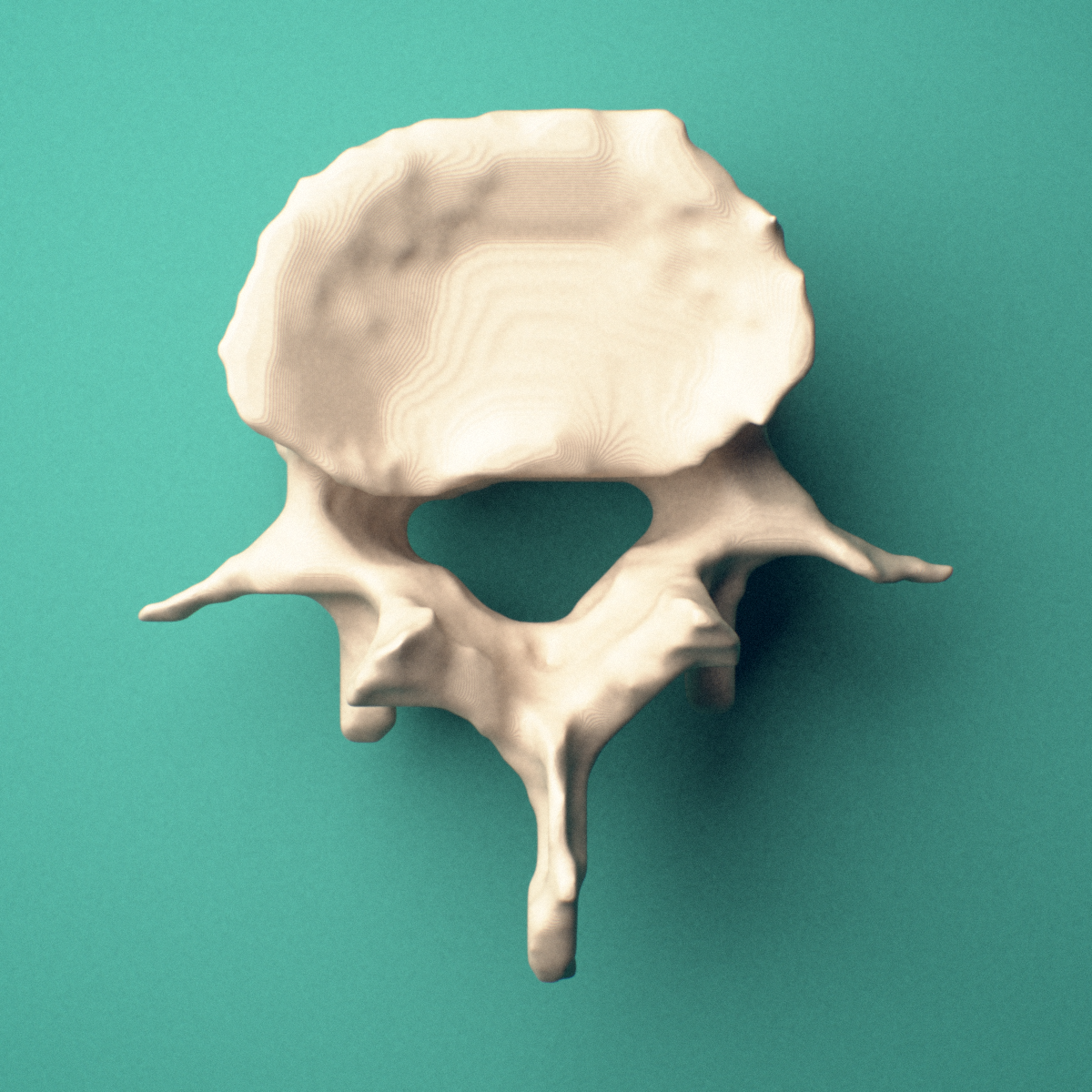 3D-printed L4 lumbar vertebra, superior oblique view showing the spinous process and superior articular processes.