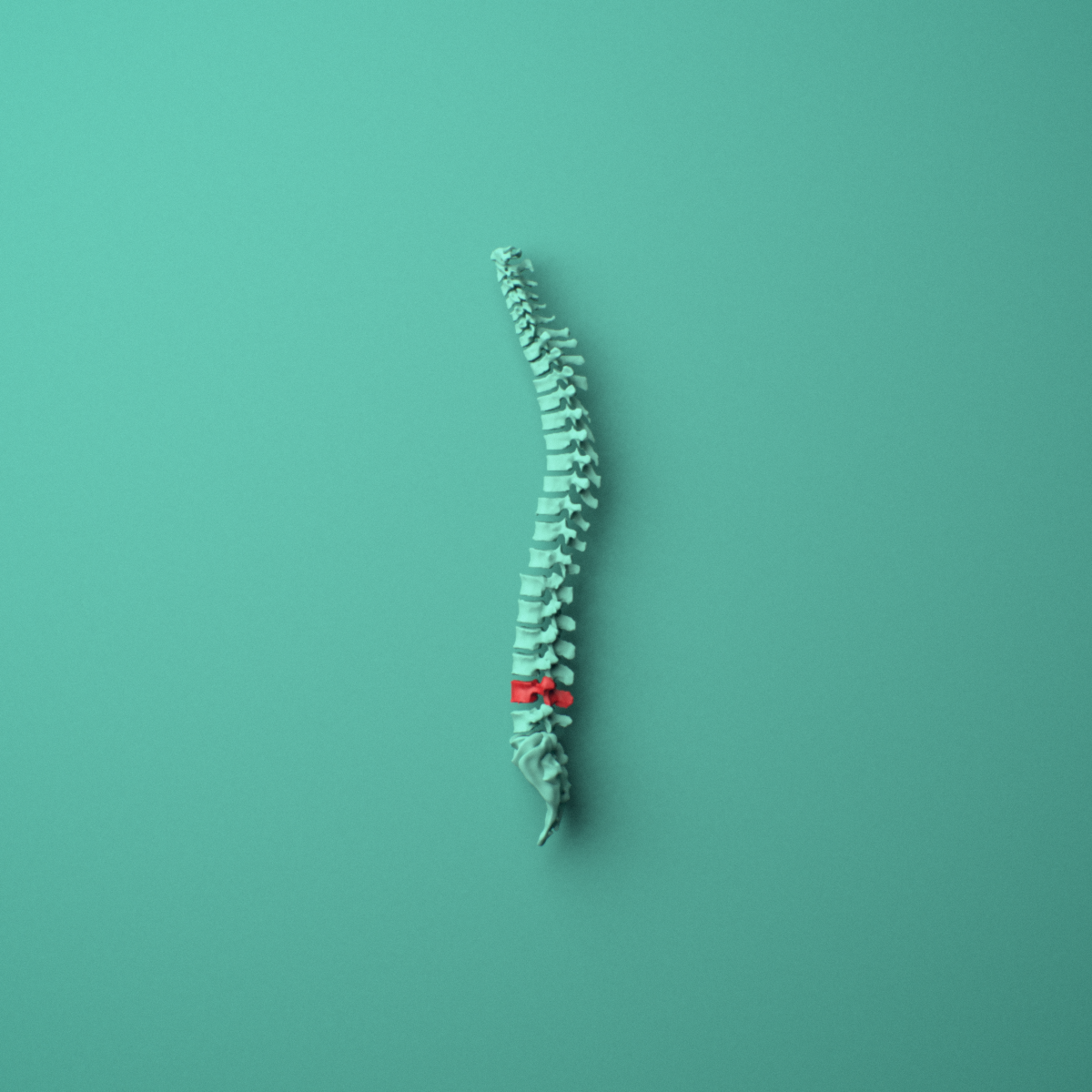 3D model of the L4 lumbar vertebra shown in position within a full lumbar spine model, left lateral view.