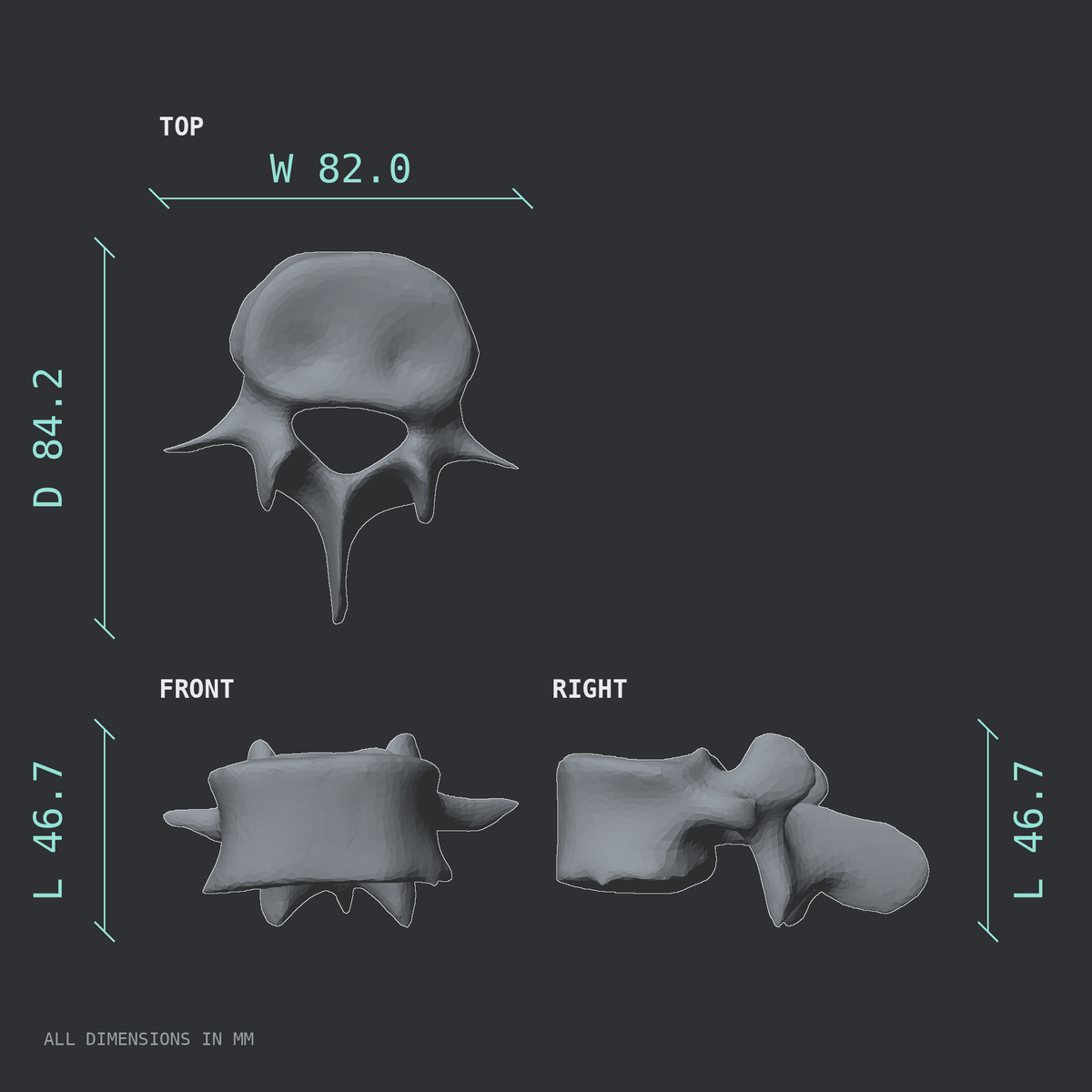 3D rendered dimensional drawing of the L4 lumbar vertebra, top, front, and side views.