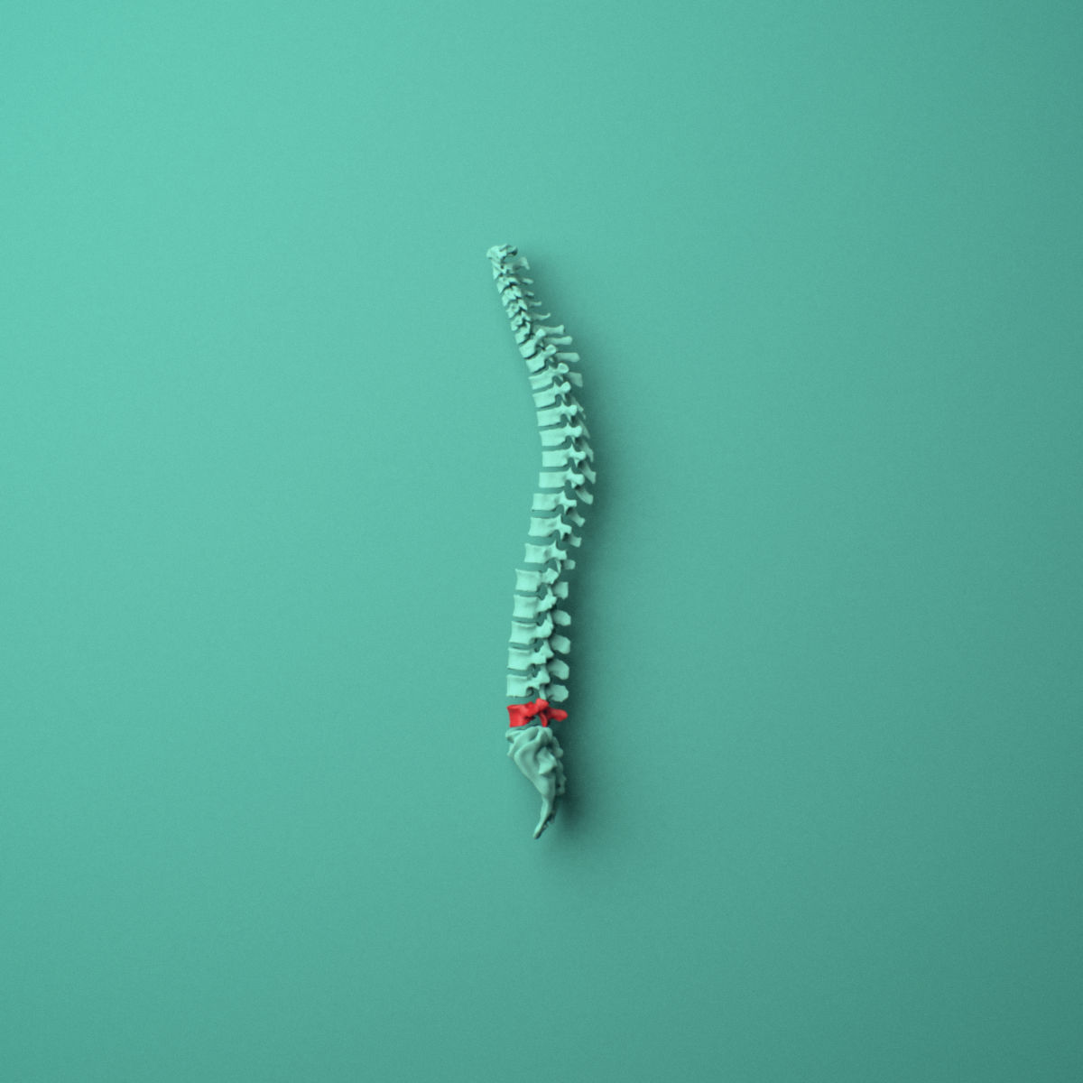 3D model of the L5 lumbar vertebra shown in position within a full lumbar spine model, left lateral view.