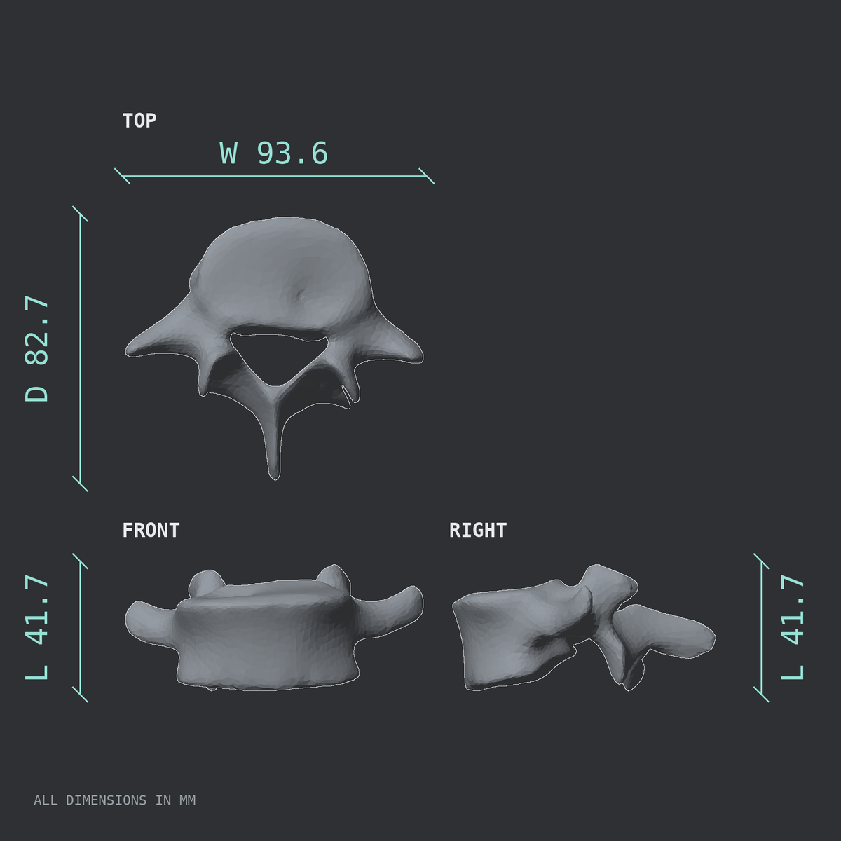 3D rendered dimensional drawing of the L5 lumbar vertebra, top, front, and side views.