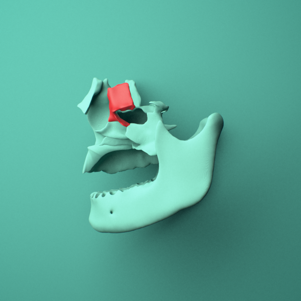 3D model of the Left lacrimal bone shown in position within a full skull model, left lateral view.