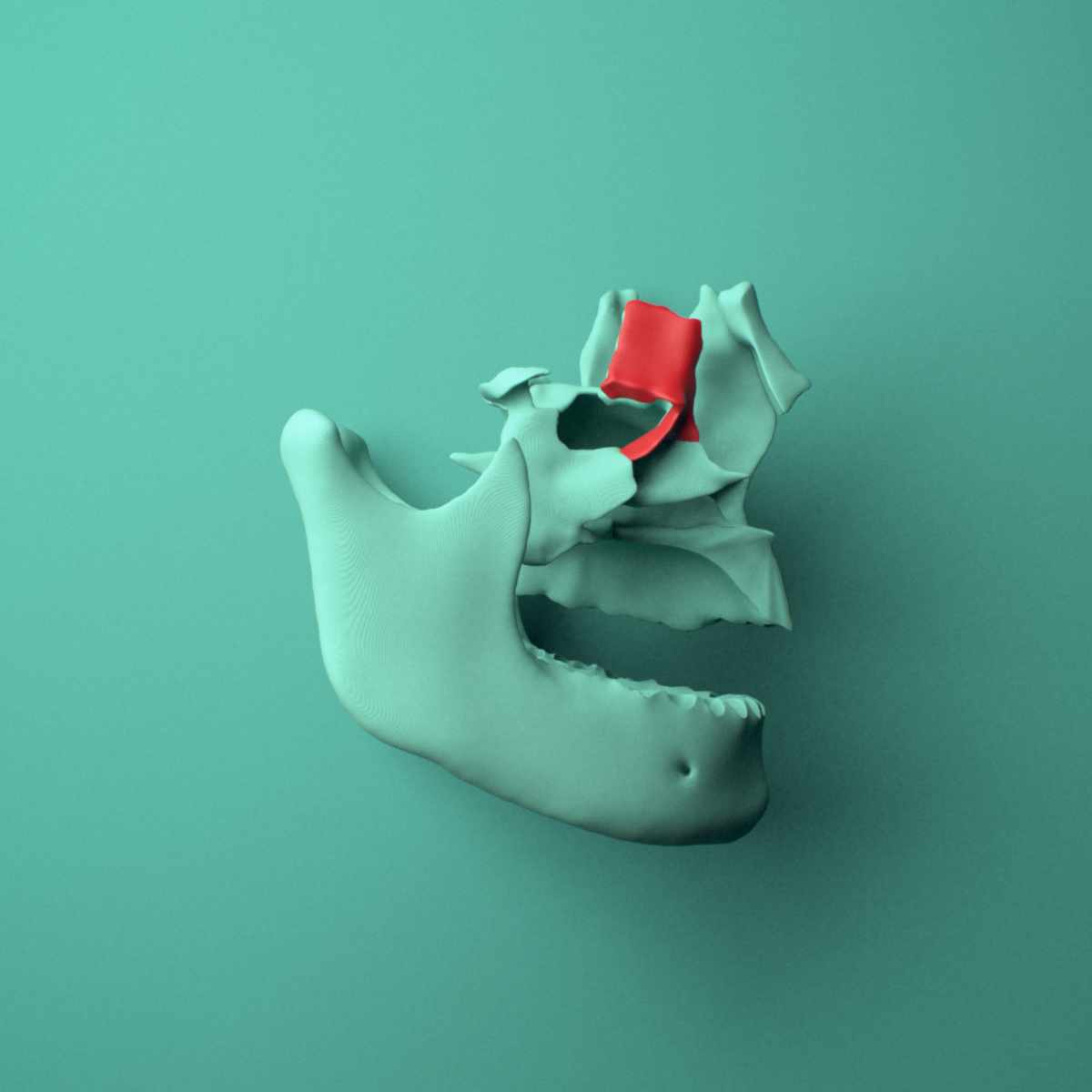 3D model of the Right lacrimal bone shown in position within a full skull model, right lateral view.