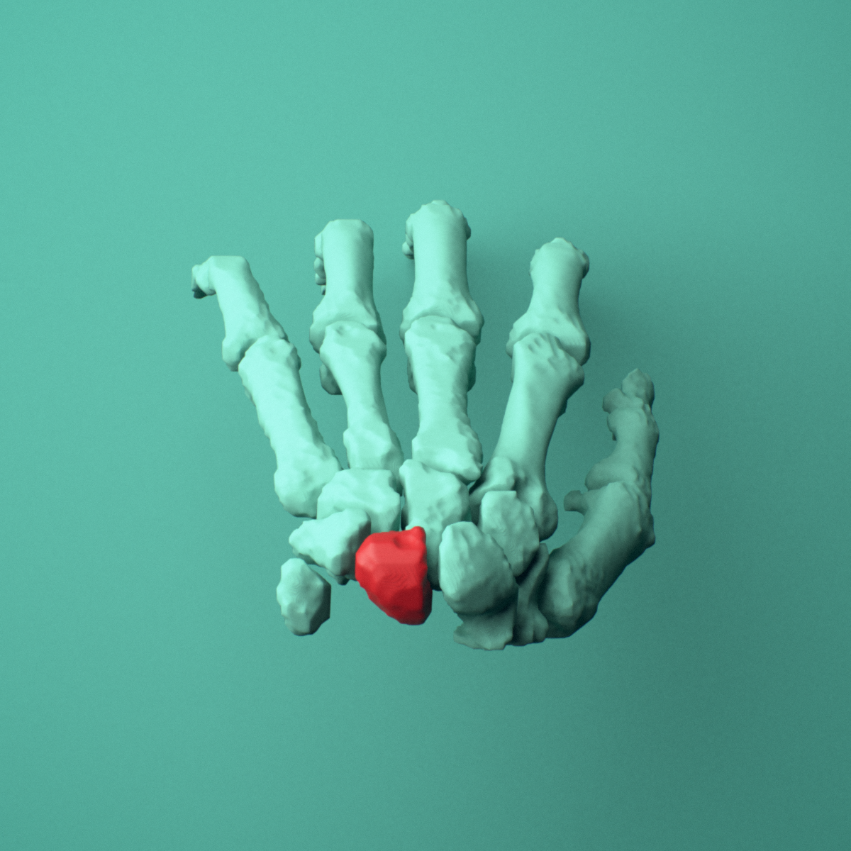 3D model of the Left lunate bone (wrist) shown in position within a full hand and wrist model, superior view.