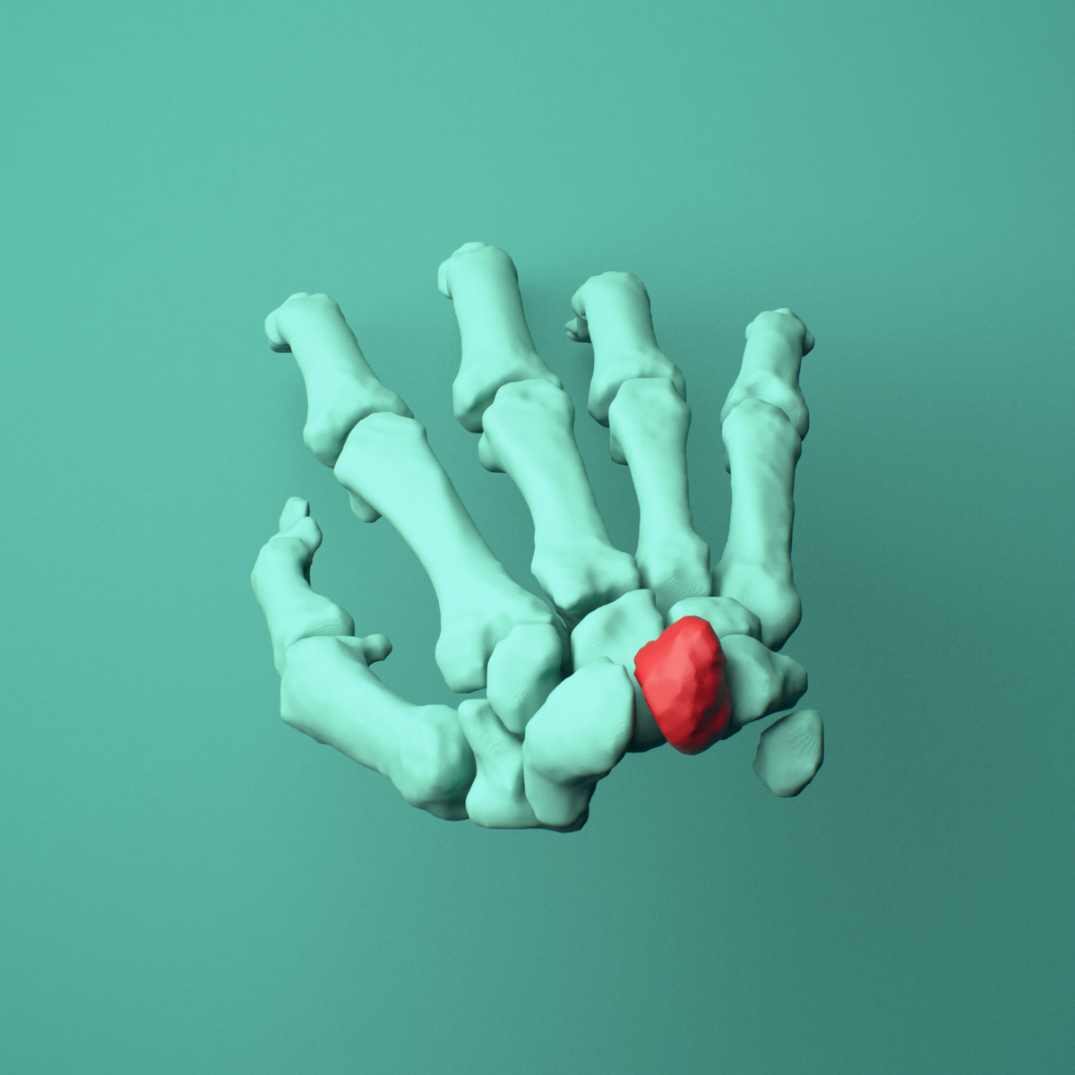 3D model of the Right lunate bone (wrist) shown in position within a full hand and wrist model, superior view.