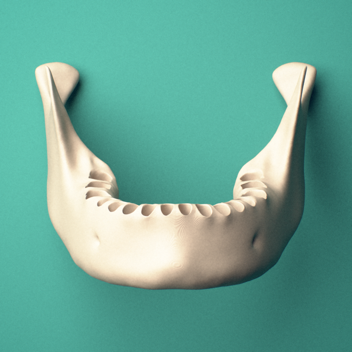 3D-printed Mandible (lower jaw bone), posterior oblique view showing the ramus.