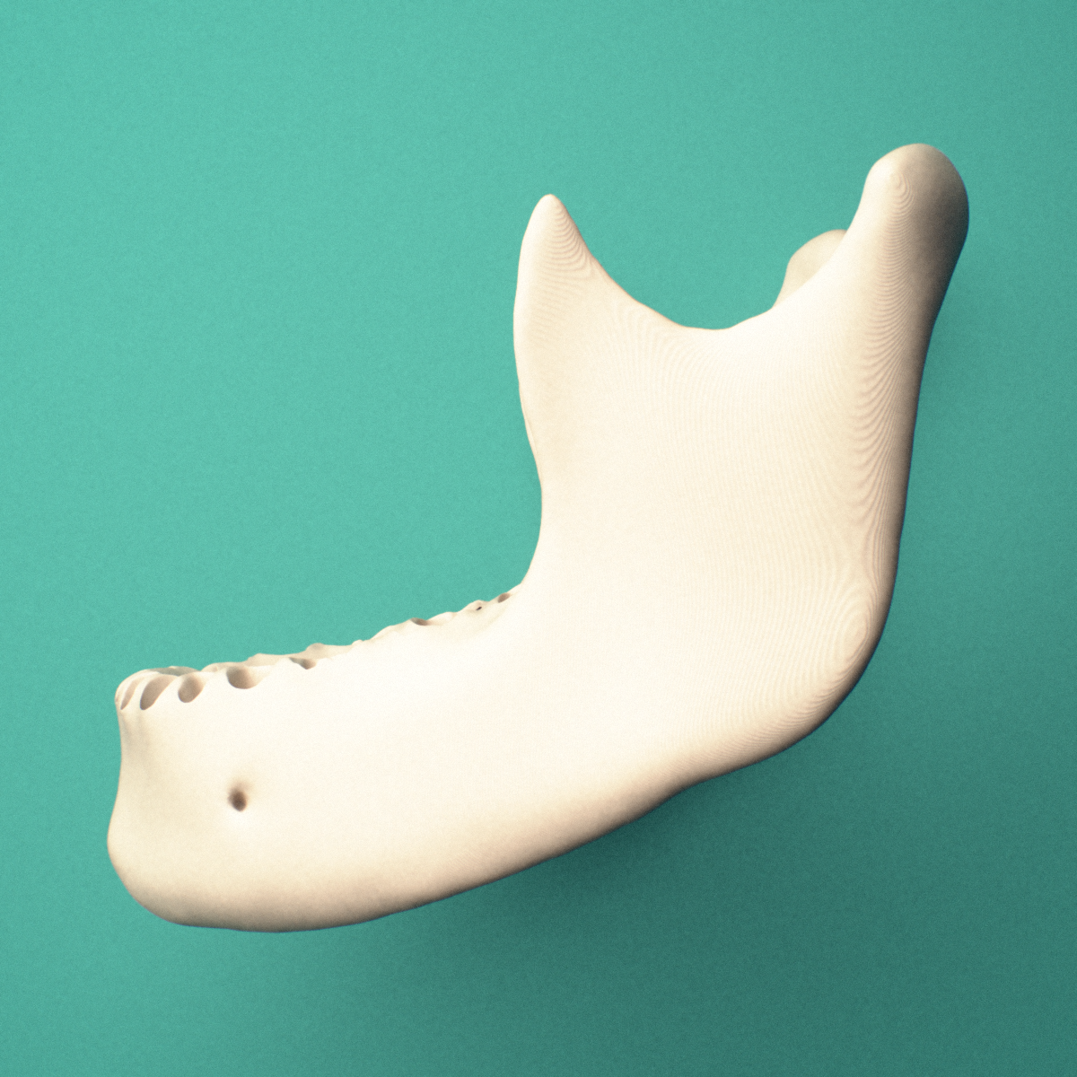 3D-printed Mandible (lower jaw bone), oblique close-up view showing the body and mental foramen.
