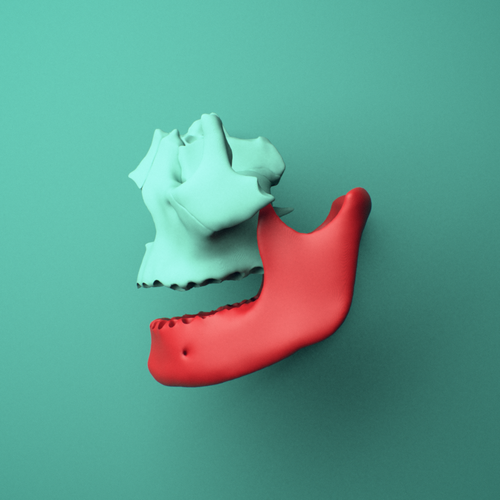 3D model of the Mandible (lower jaw bone) shown in position within a full skull model, left lateral view.