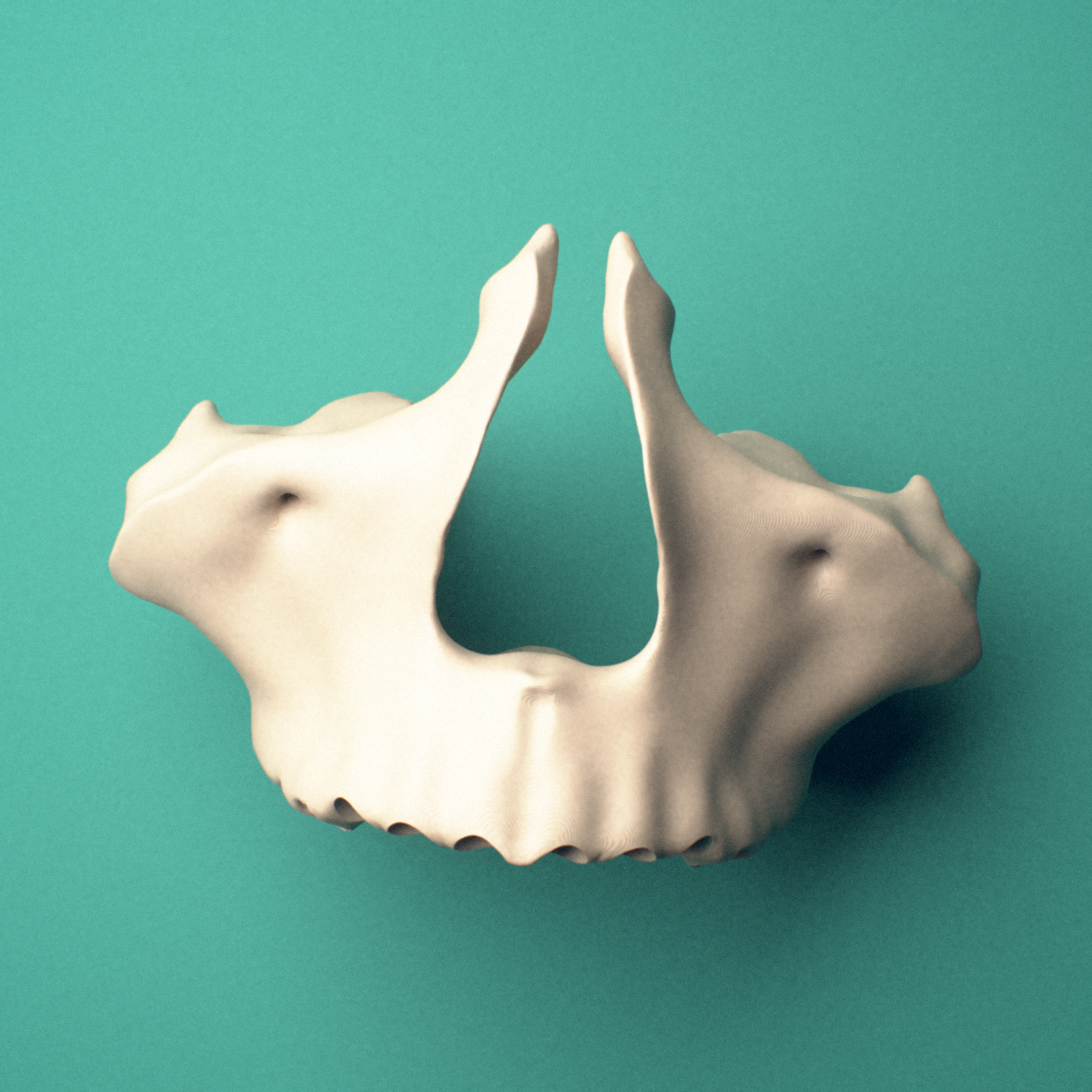 3D-printed Maxilla, fused, oblique view showing the alveolar process.