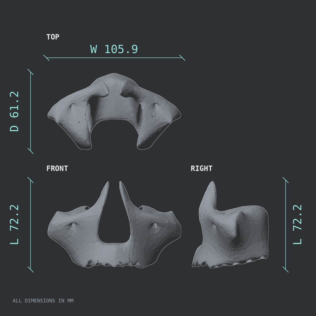 3D rendered dimensional drawing of the Maxilla, fused, top, front, and side views.