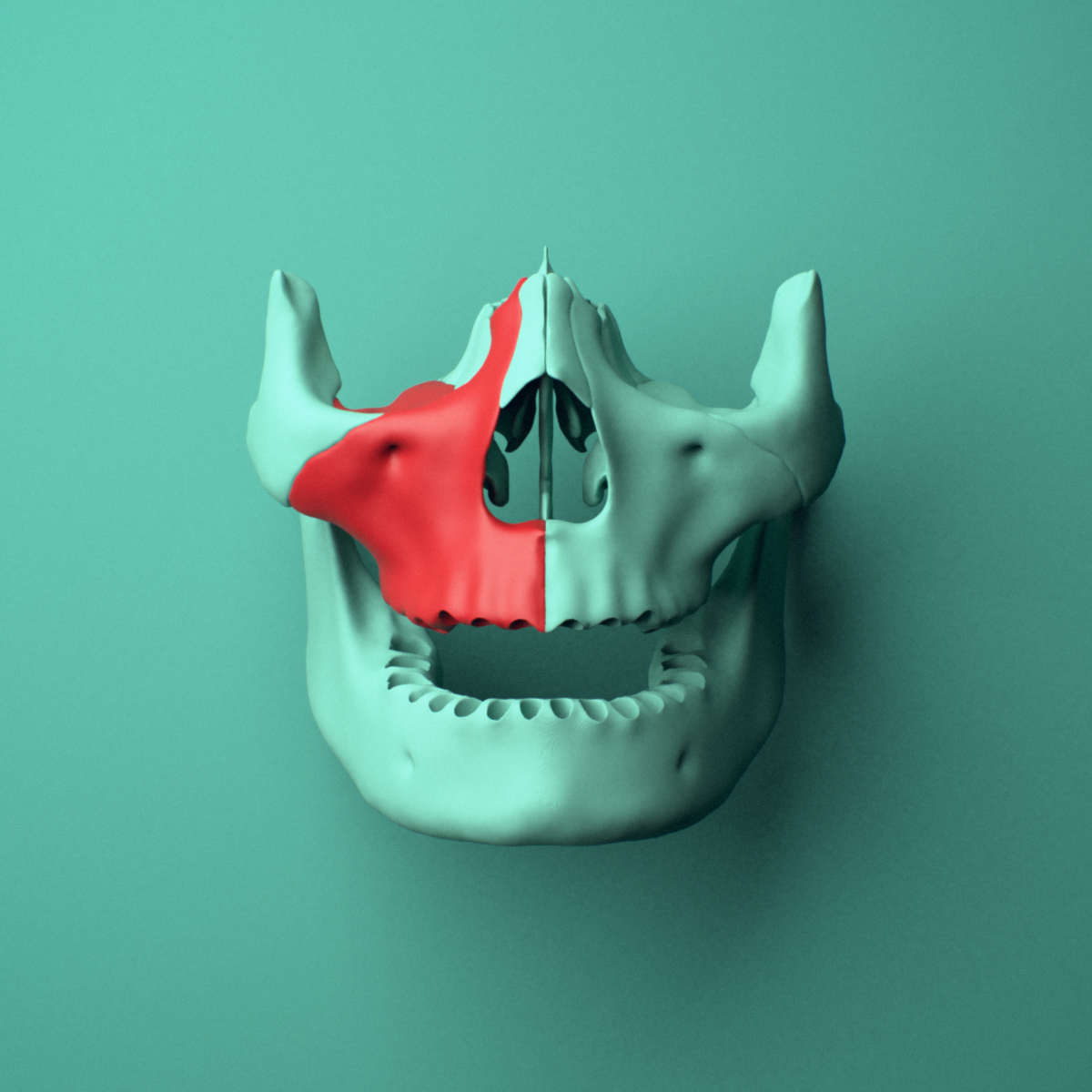 3D model of the Right maxilla shown in position within a full skull model, anterior view.