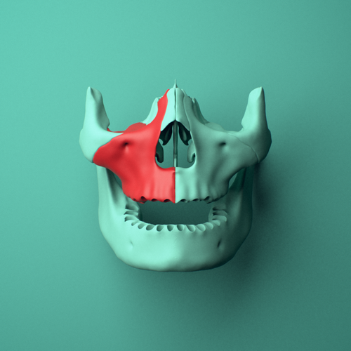 3D model of the Right maxilla shown in position within a full skull model, anterior view.