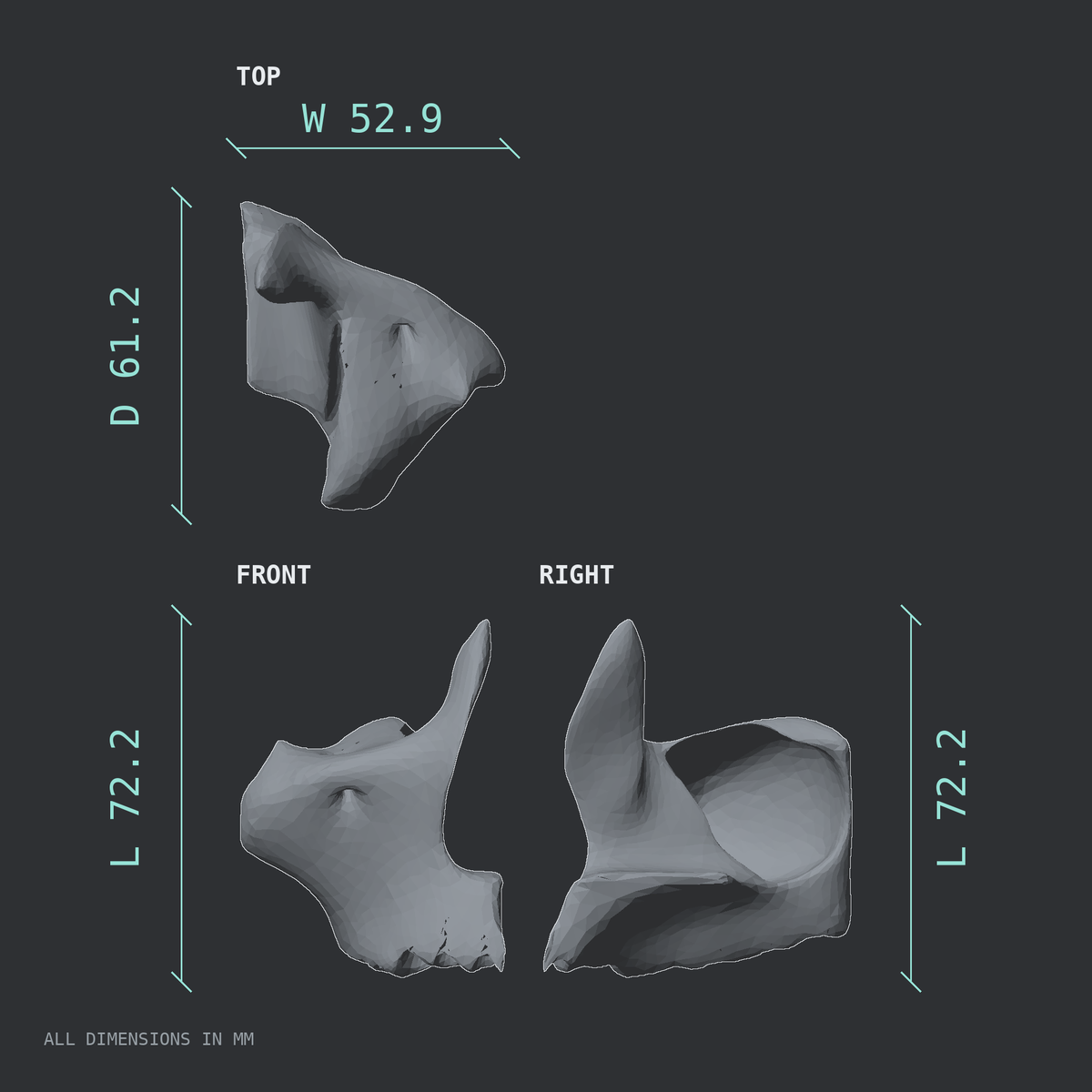 3D rendered dimensional drawing of the Left maxilla, top, front, and side views.