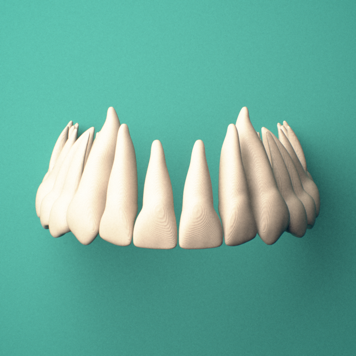 3D-printed Maxillary teeth (upper jaw), lateral oblique view showing the roots.