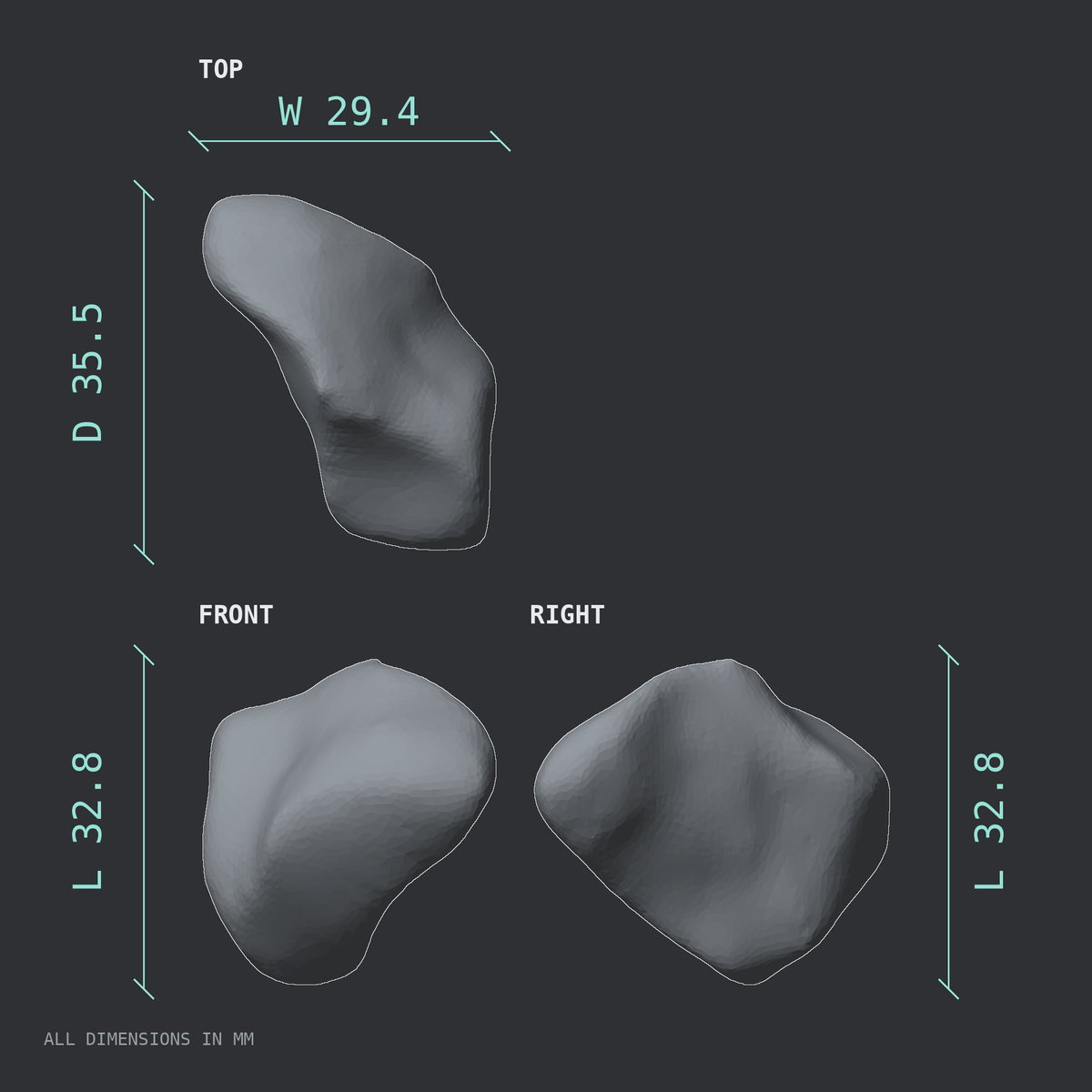 3D rendered dimensional drawing of the Left medial cuneiform (foot), top, front, and side views.