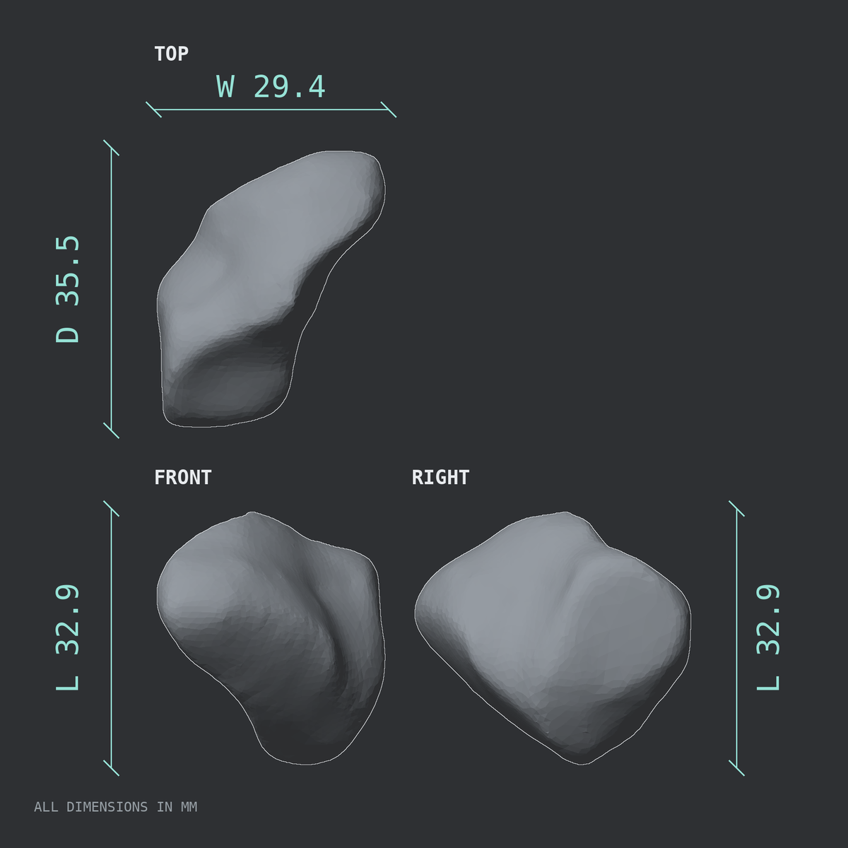 3D rendered dimensional drawing of the Right medial cuneiform (foot), top, front, and side views.