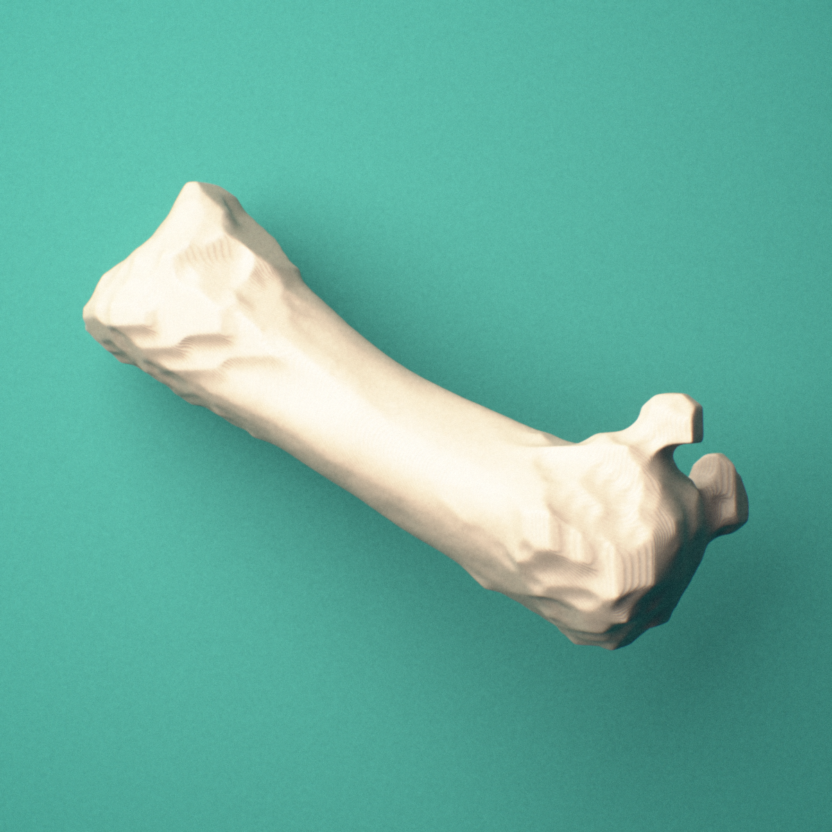 3D-printed Left first metacarpal (hand), oblique view showing the base and head.