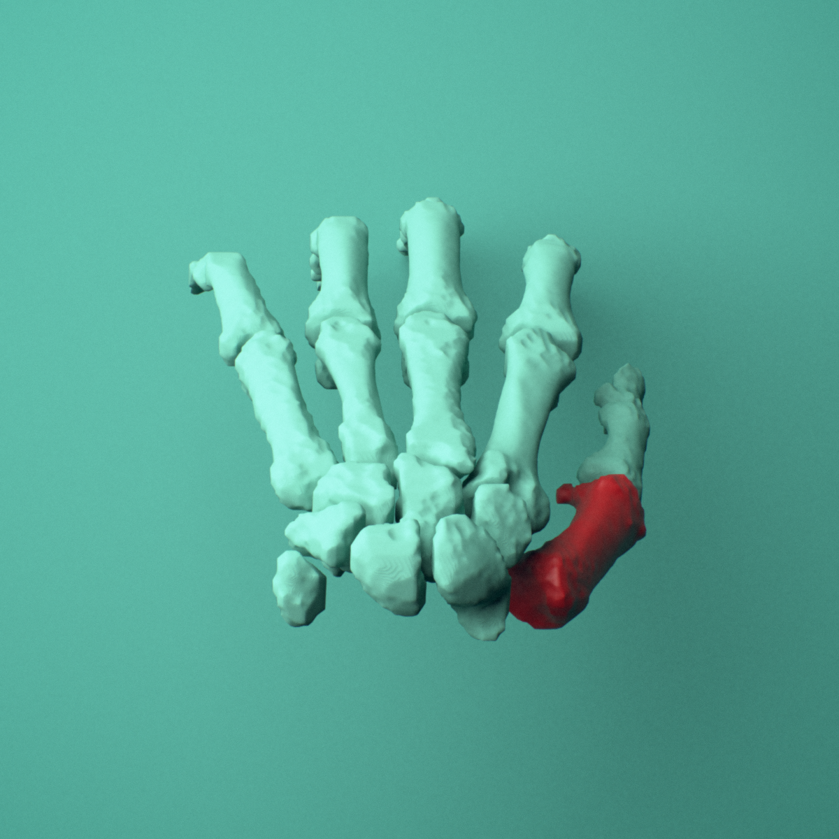 3D model of the Left first metacarpal (hand) shown in position within a full hand and wrist model, superior view.