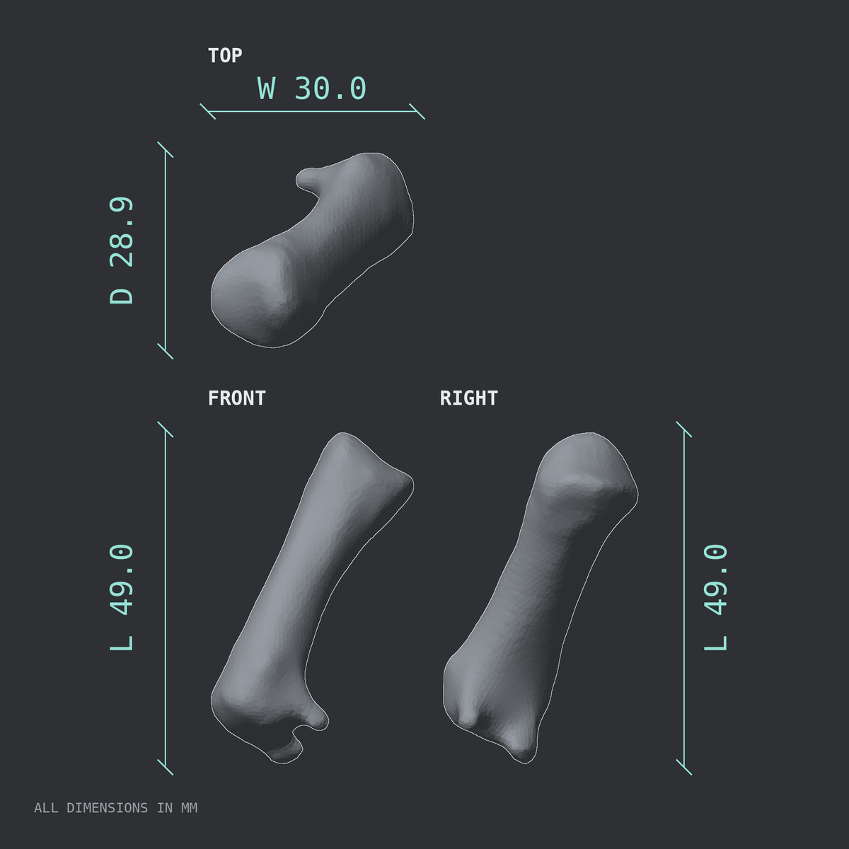 3D rendered dimensional drawing of the Left first metacarpal (hand), top, front, and side views.
