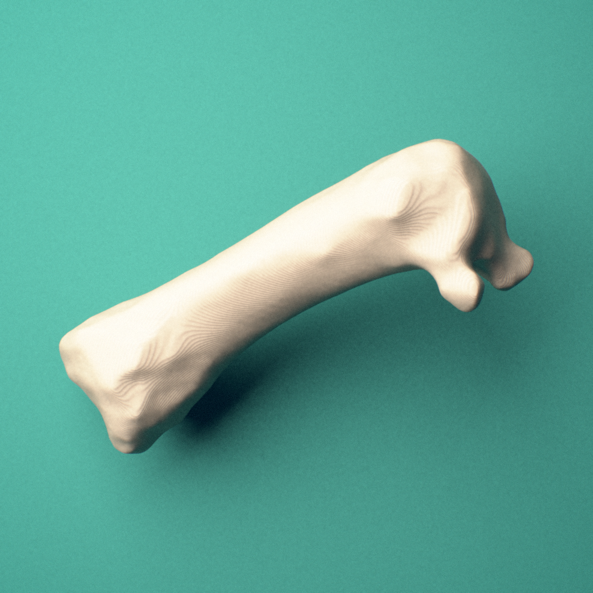 3D-printed Right first metacarpal (hand), oblique view showing the base and head.