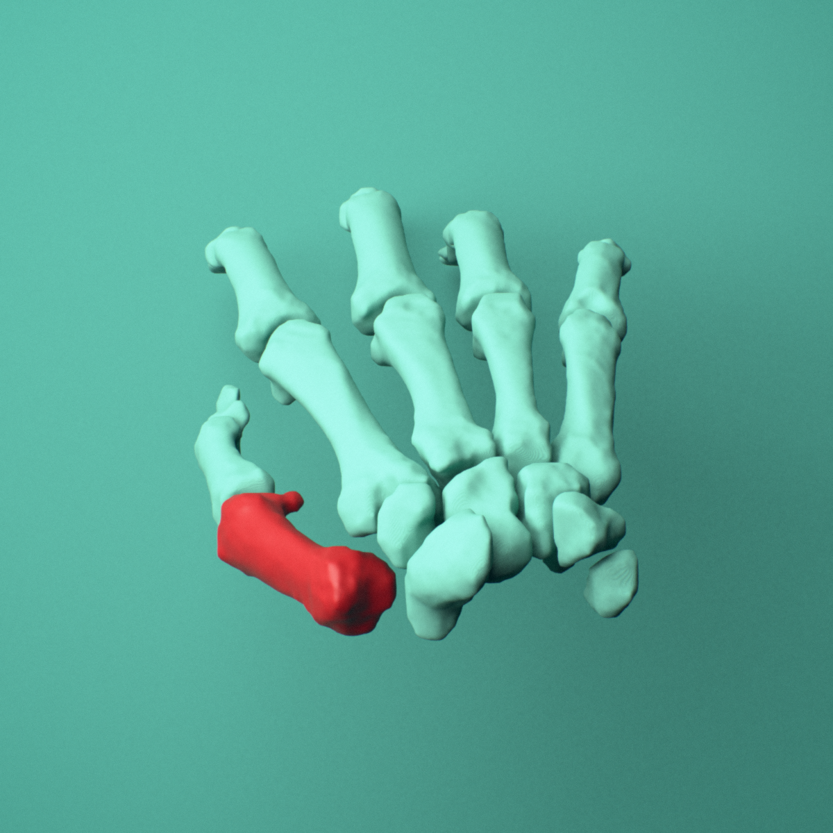 3D model of the Right first metacarpal (hand) shown in position within a full hand and wrist model, superior view.