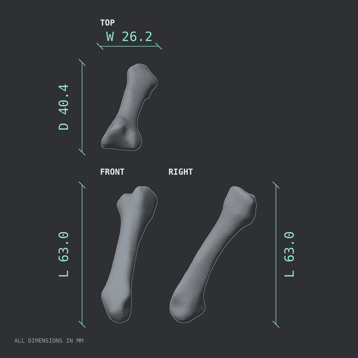 3D rendered dimensional drawing of the Left second metacarpal (hand), top, front, and side views.