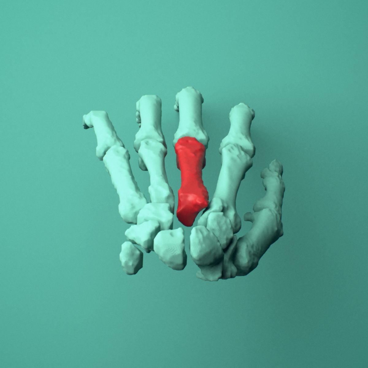 3D model of the Left third metacarpal (hand) shown in position within a full hand and wrist model, superior view.