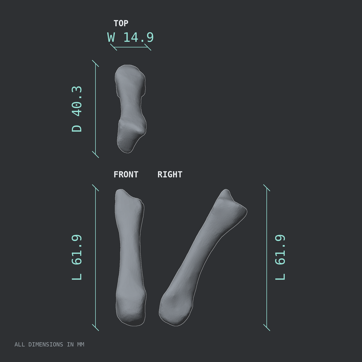 3D rendered dimensional drawing of the Left third metacarpal (hand), top, front, and side views.
