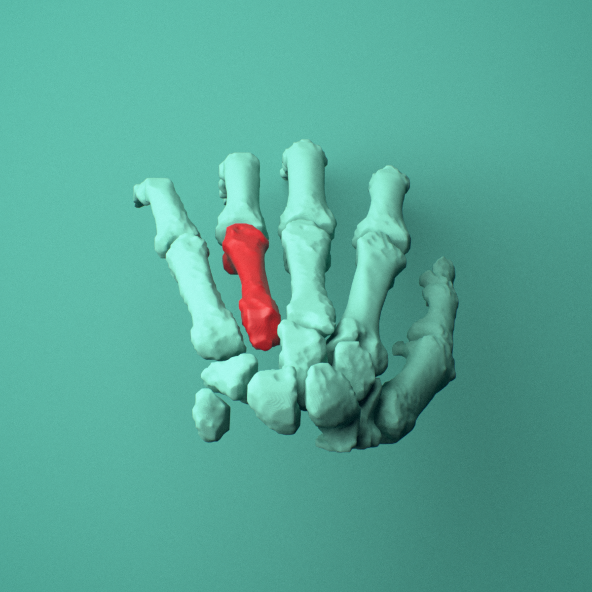 3D model of the Left fourth metacarpal (hand) shown in position within a full hand and wrist model, superior view.