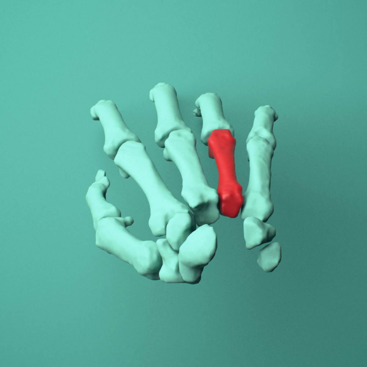 3D model of the Right fourth metacarpal (hand) shown in position within a full hand and wrist model, superior view.