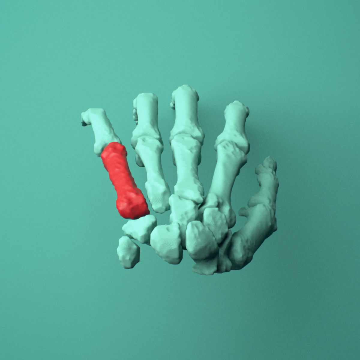 3D model of the Left fifth metacarpal (hand) shown in position within a full hand and wrist model, superior view.