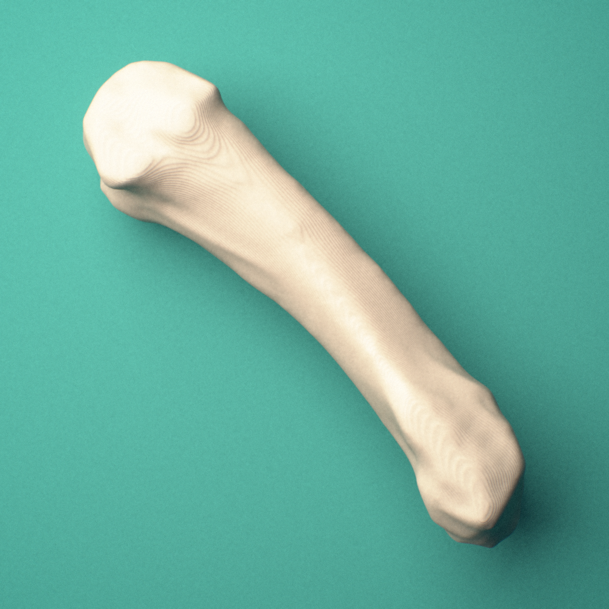 3D-printed Right fifth metacarpal (hand), oblique view showing the base and head.