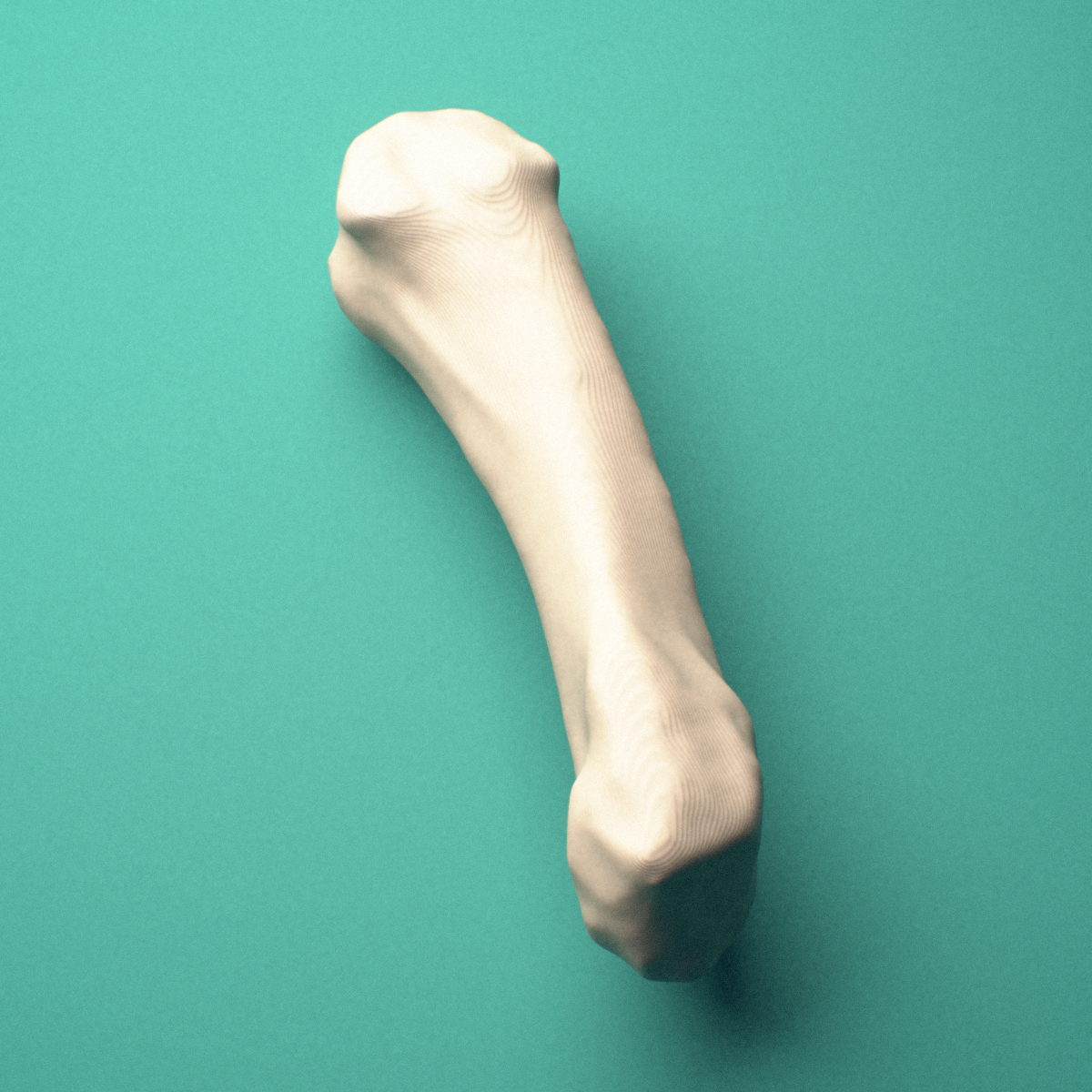 3D-printed Right fifth metacarpal (hand), close-up view showing the head.